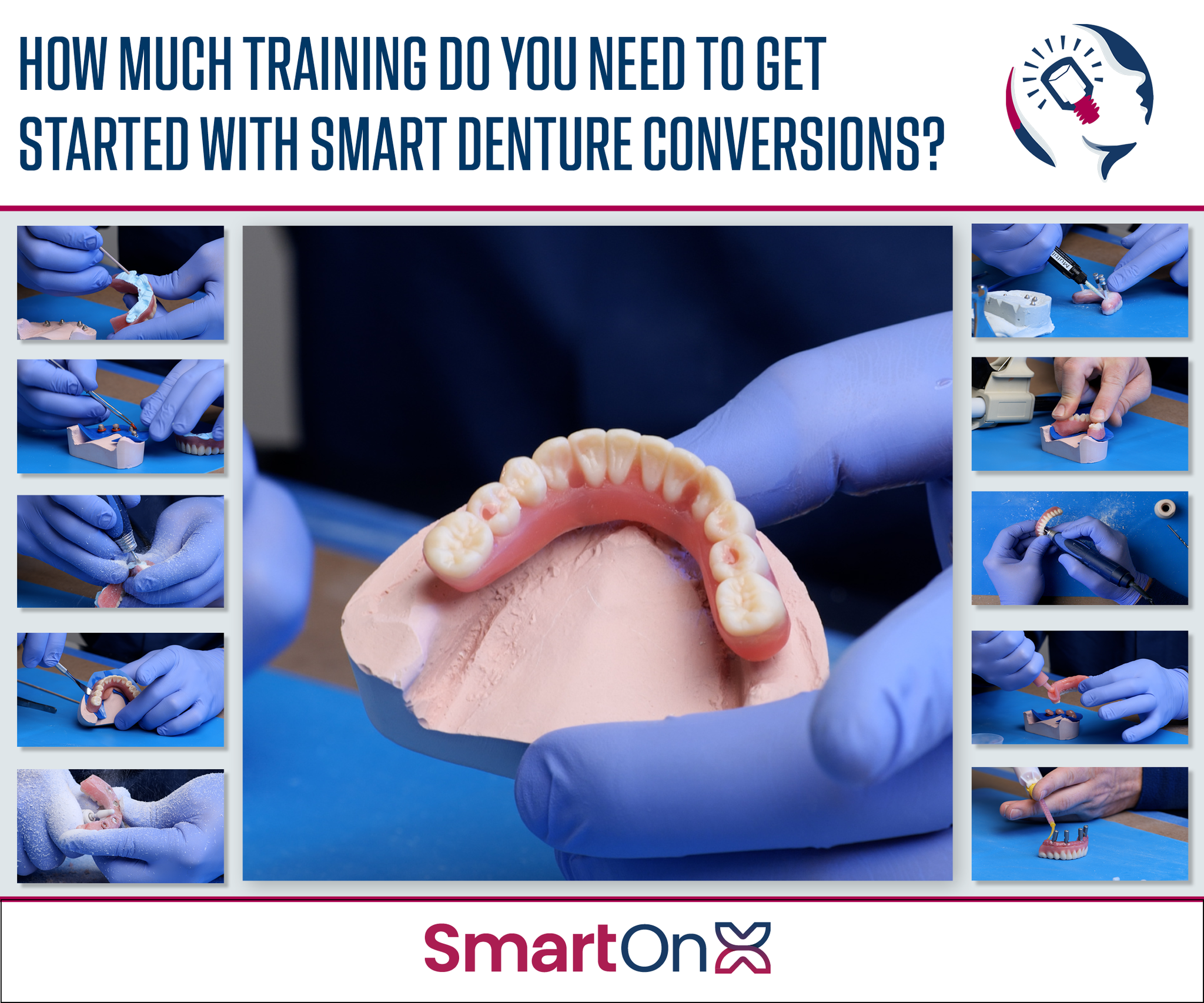 How Much Training Do You Need to Get Started with Smart Denture Conversions?