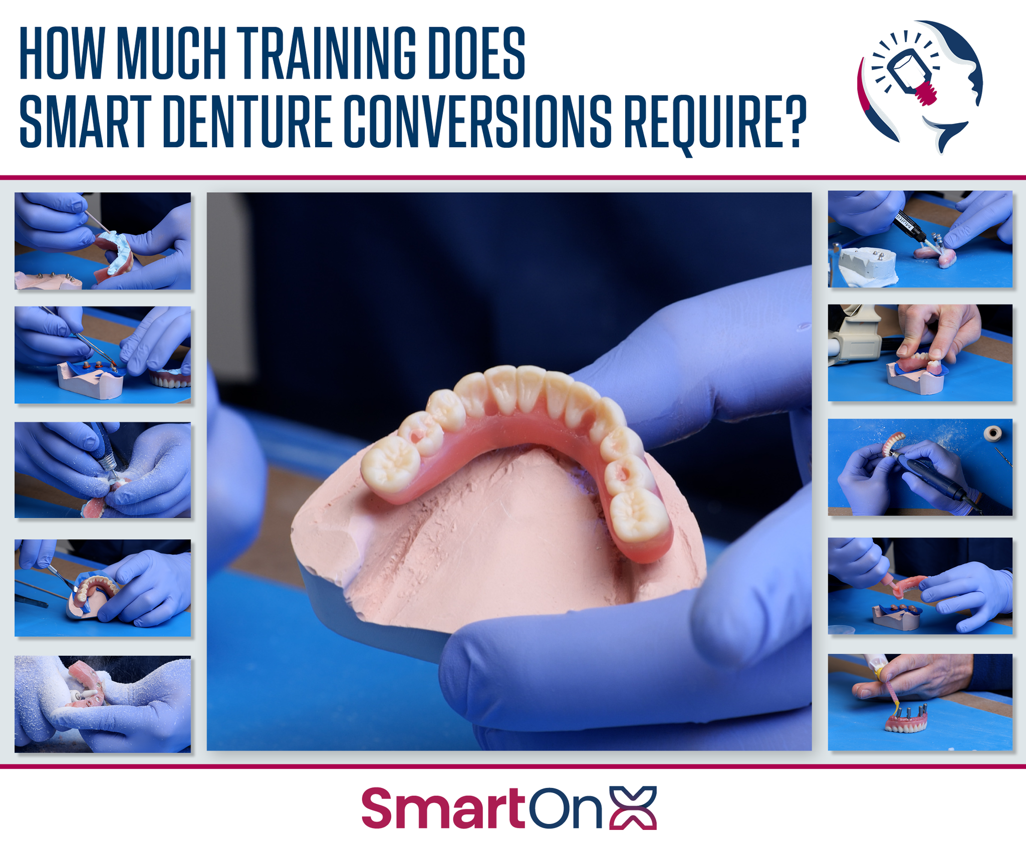 How Much Training Do You Need to Get Started with Smart Denture Conversions?